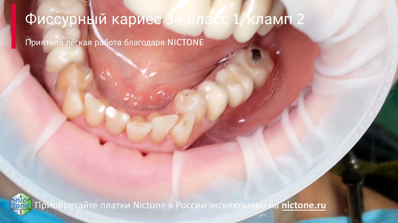 8c5ae75e727f7cd7fe88af95996d47c5